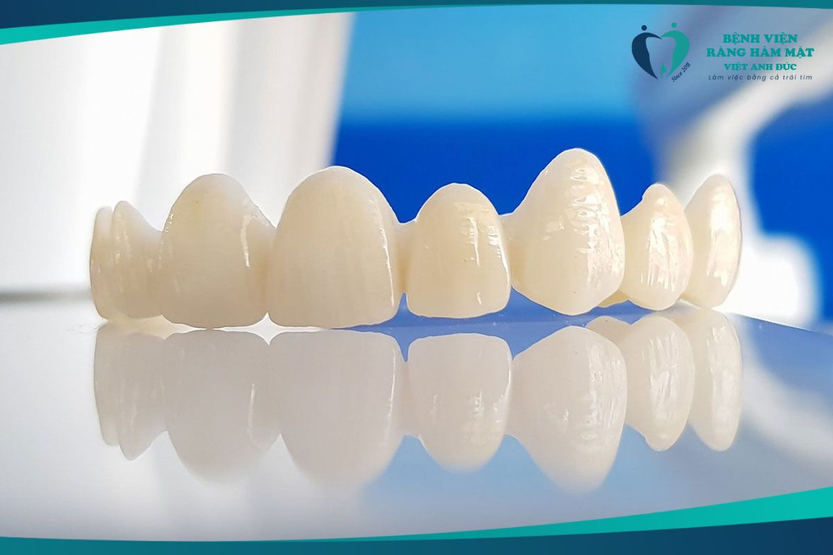 Toàn sứ Zirconia
