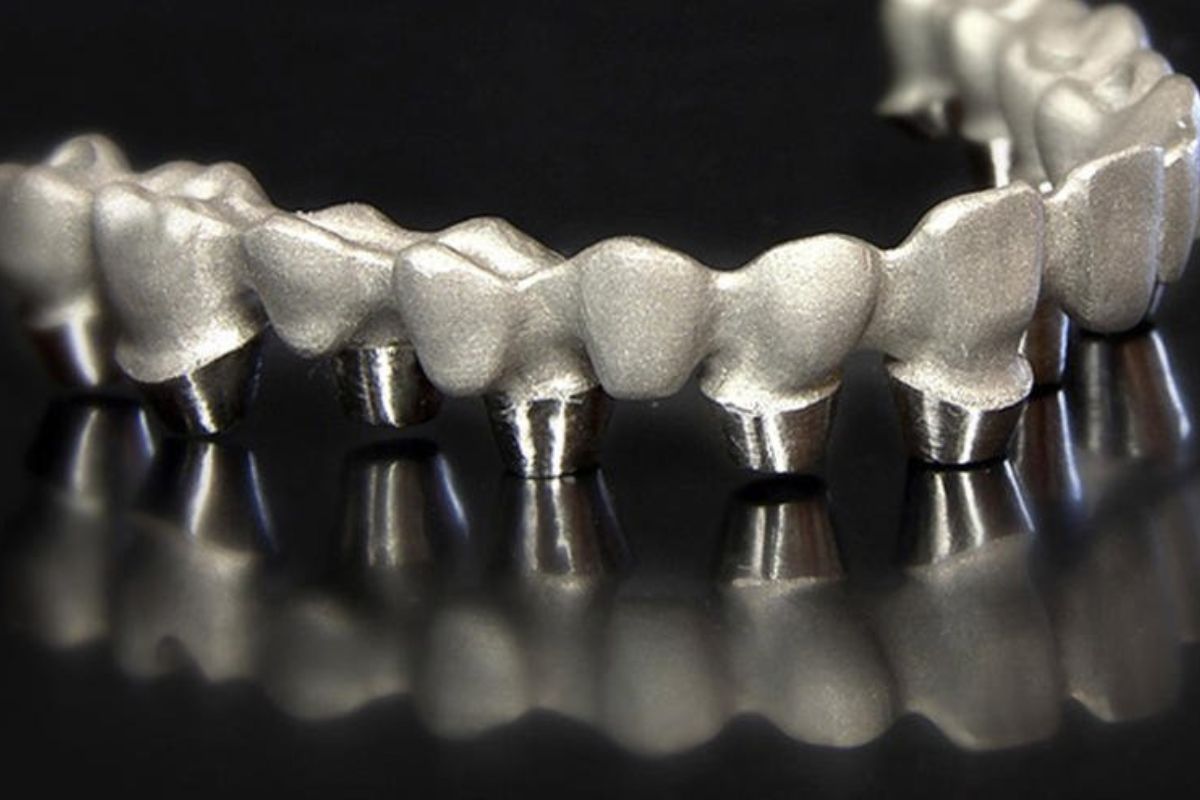 Phục hình sứ kim loại