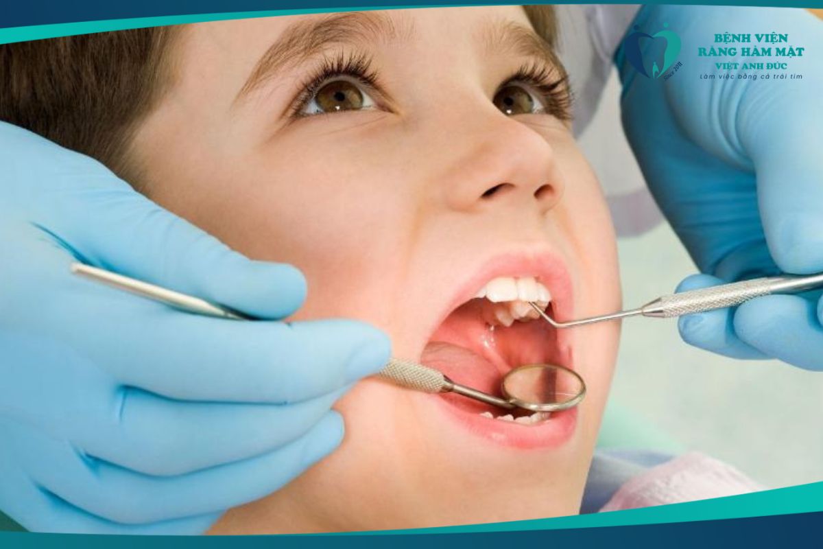 Vấn đề răng miệng hay gặp ở trẻ