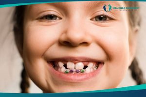 chỉnh nha trẻ em